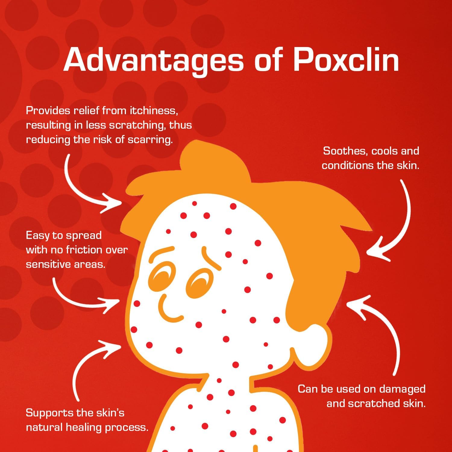 PoxClin CoolMousse Chickenpox Treatment for Children, Relieve Symptoms and Itch of Chickenpox, Natural Ingredients, 100 ml : Amazon.co.uk: Health & Personal Care