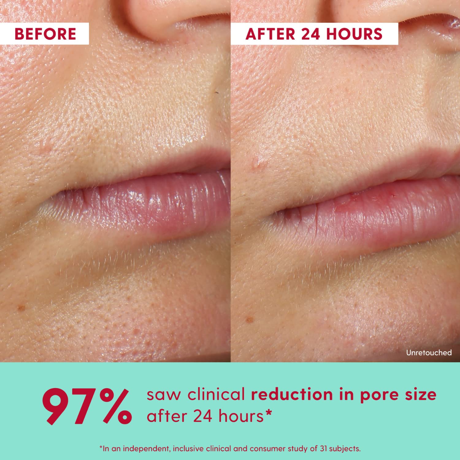 Kinship Self Smooth 10% Glycolic Pore Minimizing Toner-Serum - Exfoliating Glycolic Acid - Overnight Resurfacing Treatment - Brighten, Smooth, Hydrate - Aha + Vitamin C Facial Toner (2.2 Fl Oz) : Beauty & Personal Care