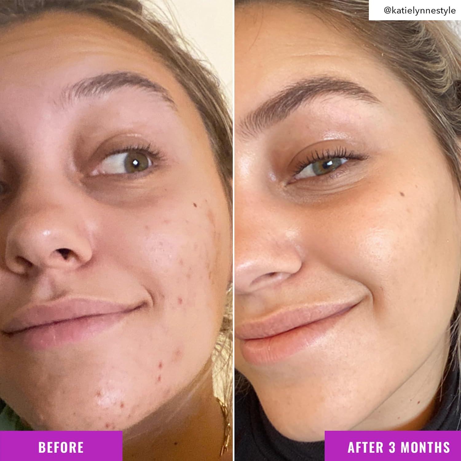 Good Molecules Niacinamide Brightening Toner - Toner For Face With Niacinamide And Arbutin For Skin Tone Balancing- Pore Minimizer, Facial Skin Care : Beauty & Personal Care