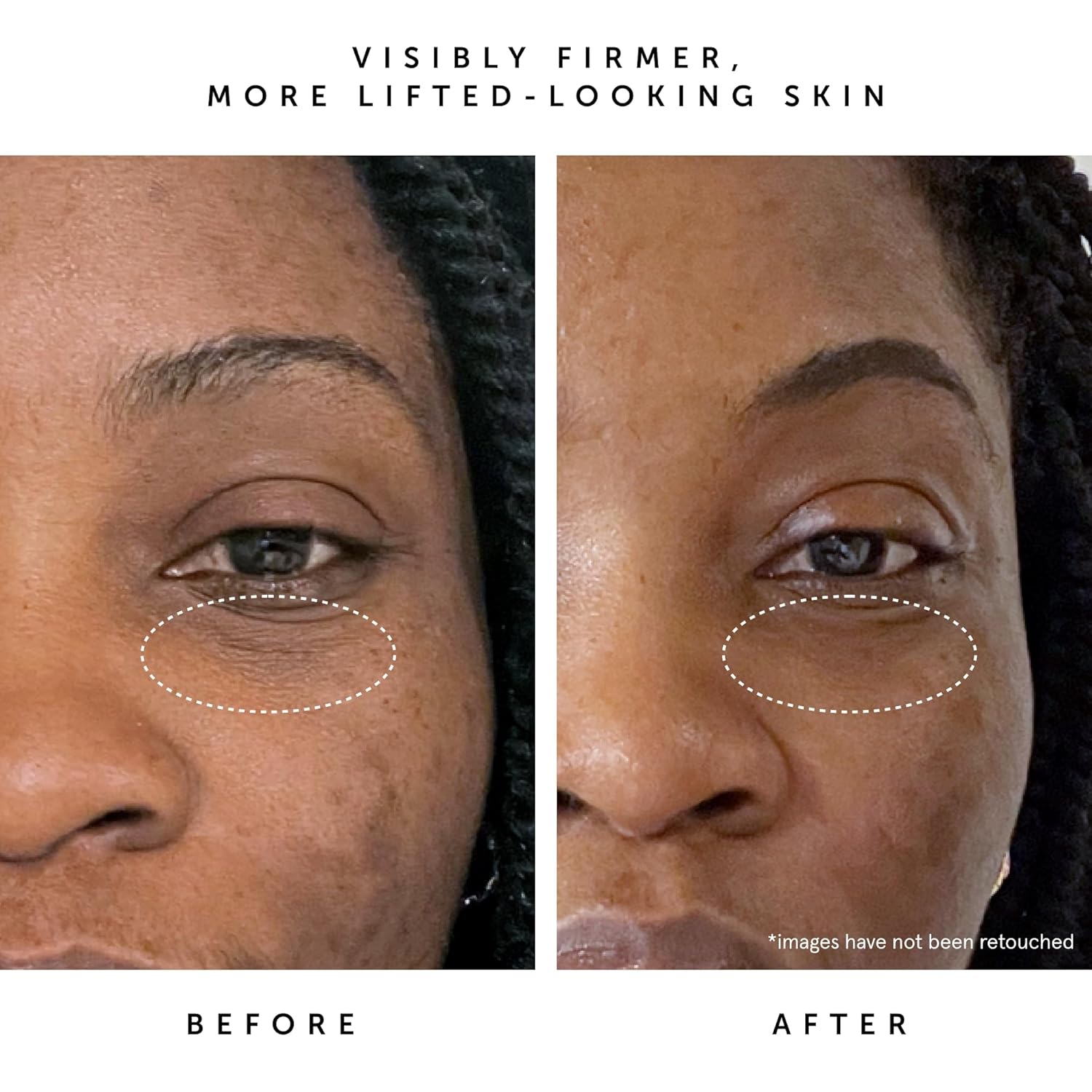 Herbivore Bakuchiol Retinol Alternative Face Serum Regular Strength - Bakuchiol + Peptides, Smooths Skin, Reduces Fine Lines & Wrinkles, Plant-Based, Vegan, Cruelty-Free, 30Ml / 1 Oz : Beauty & Personal Care