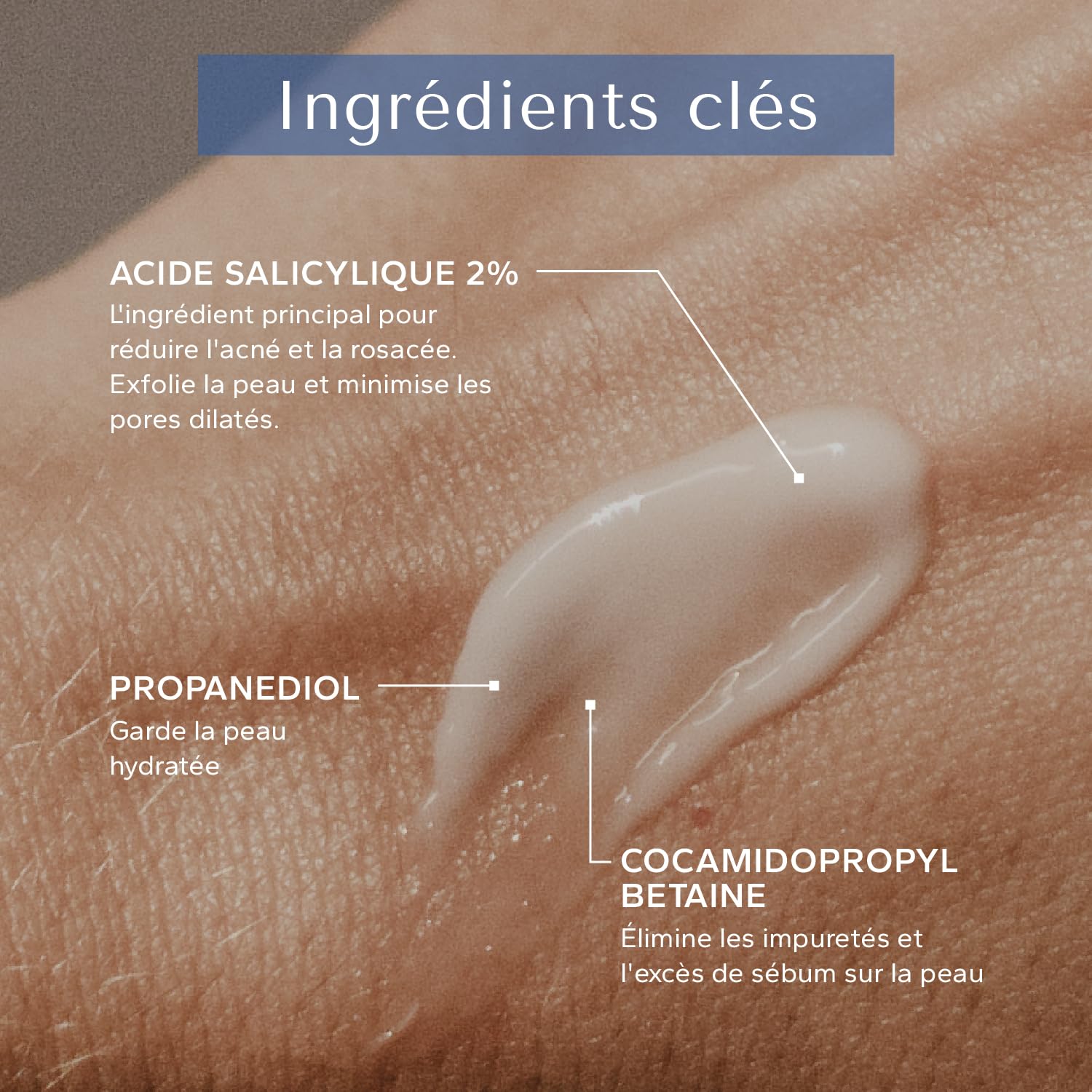 Acne Relief - 2% Salicylic Acid Cleanser