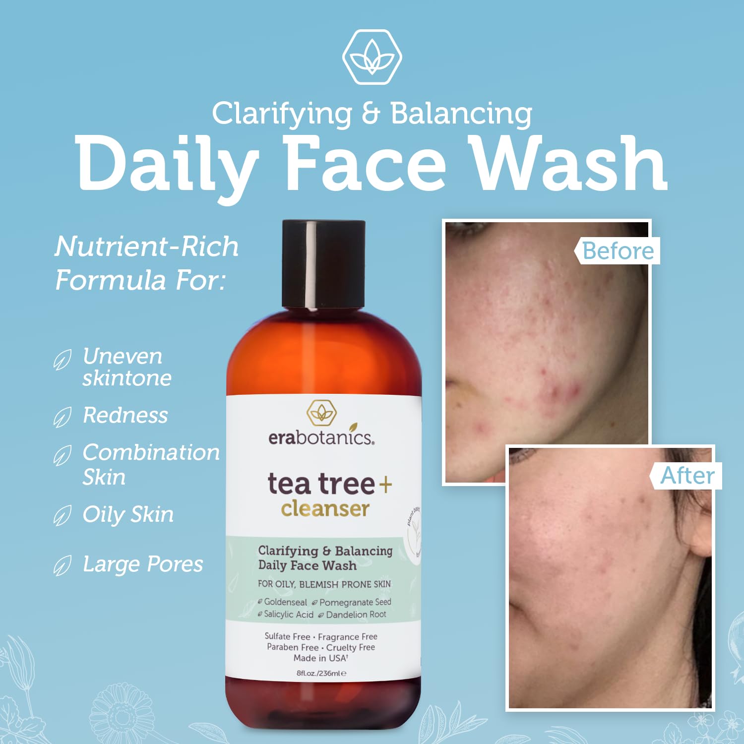 Era Organics Purifying Tea Tree Oil Face Wash - Balancing Cleanser for Oily, Blemish-Prone Skin with Salicylic Acid - Sulfate-Free, Fragrance Free, Made in USA : Beauty & Personal Care