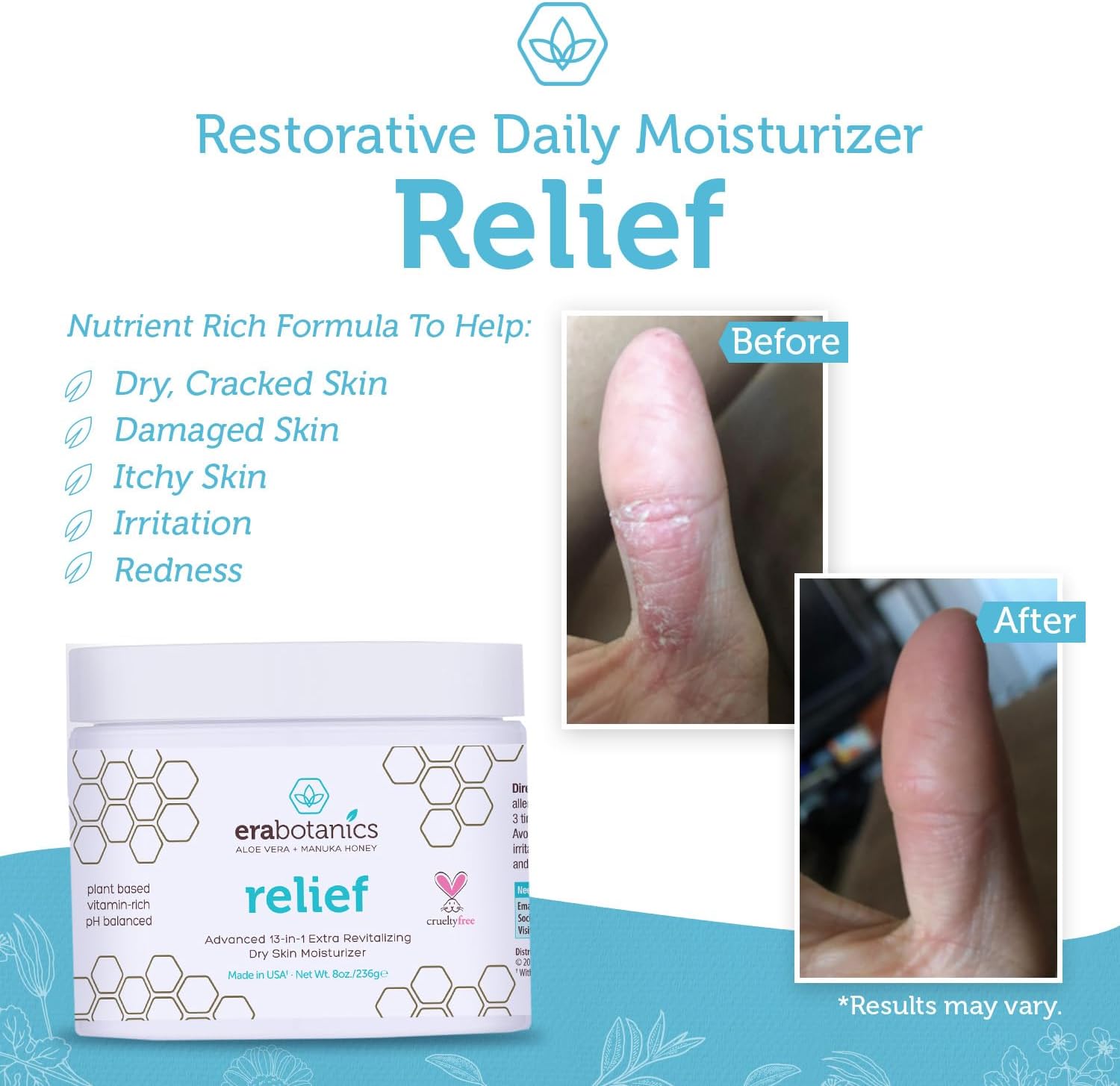 Era Organics Eczema, Psoriasis & Dermatitis Moisturizer Cream - Advanced 13-in-1 Non-Greasy Calming Moisturizer with Aloe Vera, Manuka Honey & More. Face & Body Lotion for Dry Itchy Skin 8oz : Health & Household