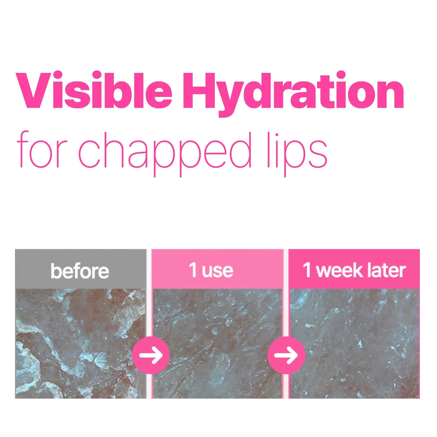 Isoi Refresh Lip Sleeping Mask, Overnight Hydrating Lip Treatment With 4X Ceramide & Botanical Oils, Korean Lip Care (0.88 Oz, 25G) : Beauty & Personal Care