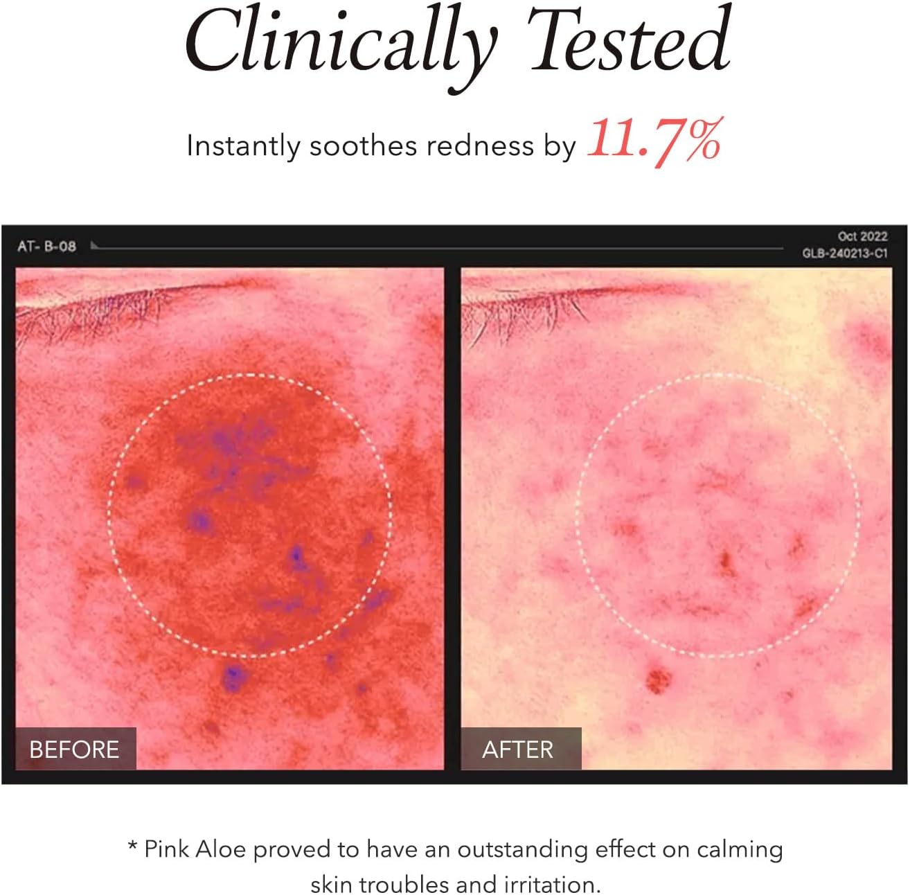 Aprilskin Pink Aloe Trouble Soothing Duo: Pink Aloe Facial Polish Cleanser And Vita Toner : Beauty & Personal Care