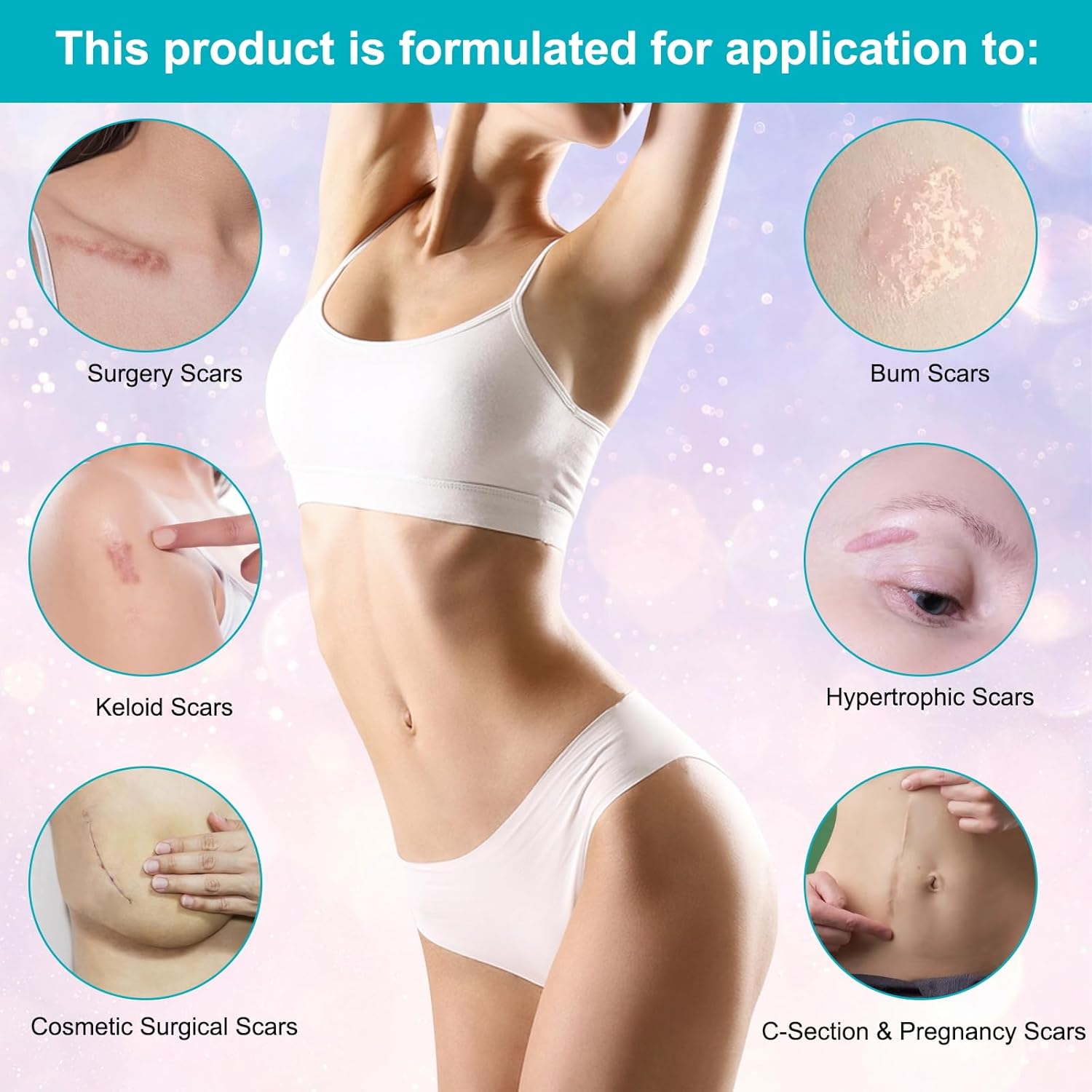 Kelinul Scar Cream - Advanced Silicone Gel For C-Section, Stretch Marks, Acne, Surgery, Effective Both Old And New Scars- Advanced Post Supplies-Try Surgical Sheets-1.7 Oz