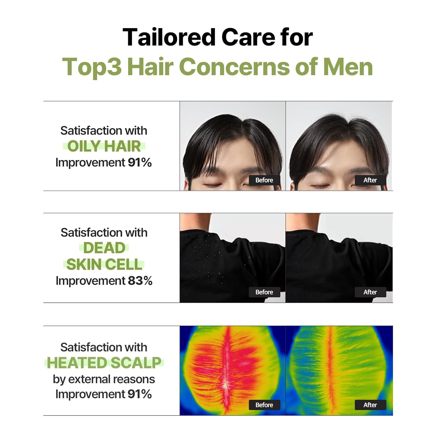 Ryo Root:Gen Hair Strength Shampoo For Men : Beauty & Personal Care