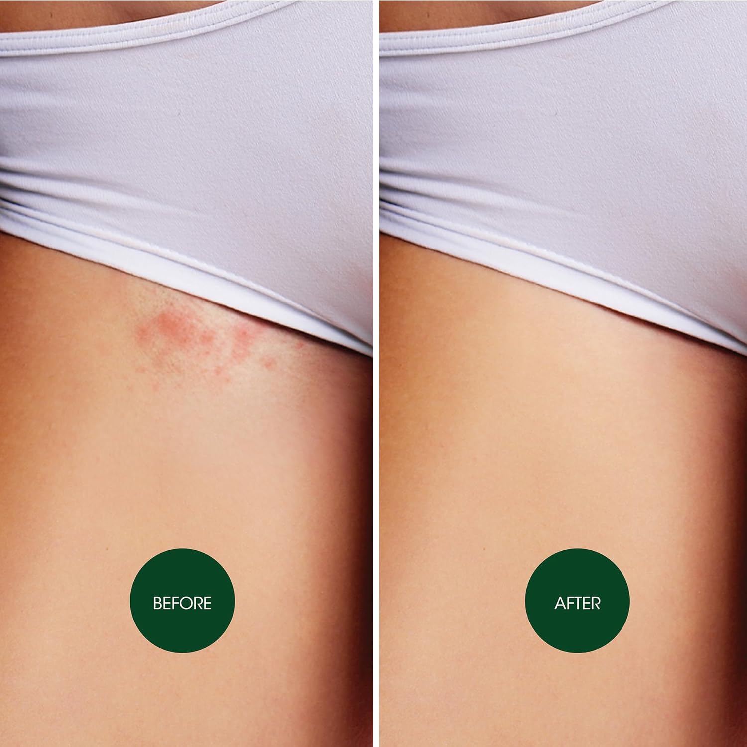 Nad's Soothing Ingrow Solution, Ingrown Hair Reduction, Treatment for Ingrown Hairs, Redness and Inflammation, Ingrown Hair Treatment, 125ml : Amazon.co.uk: Beauty