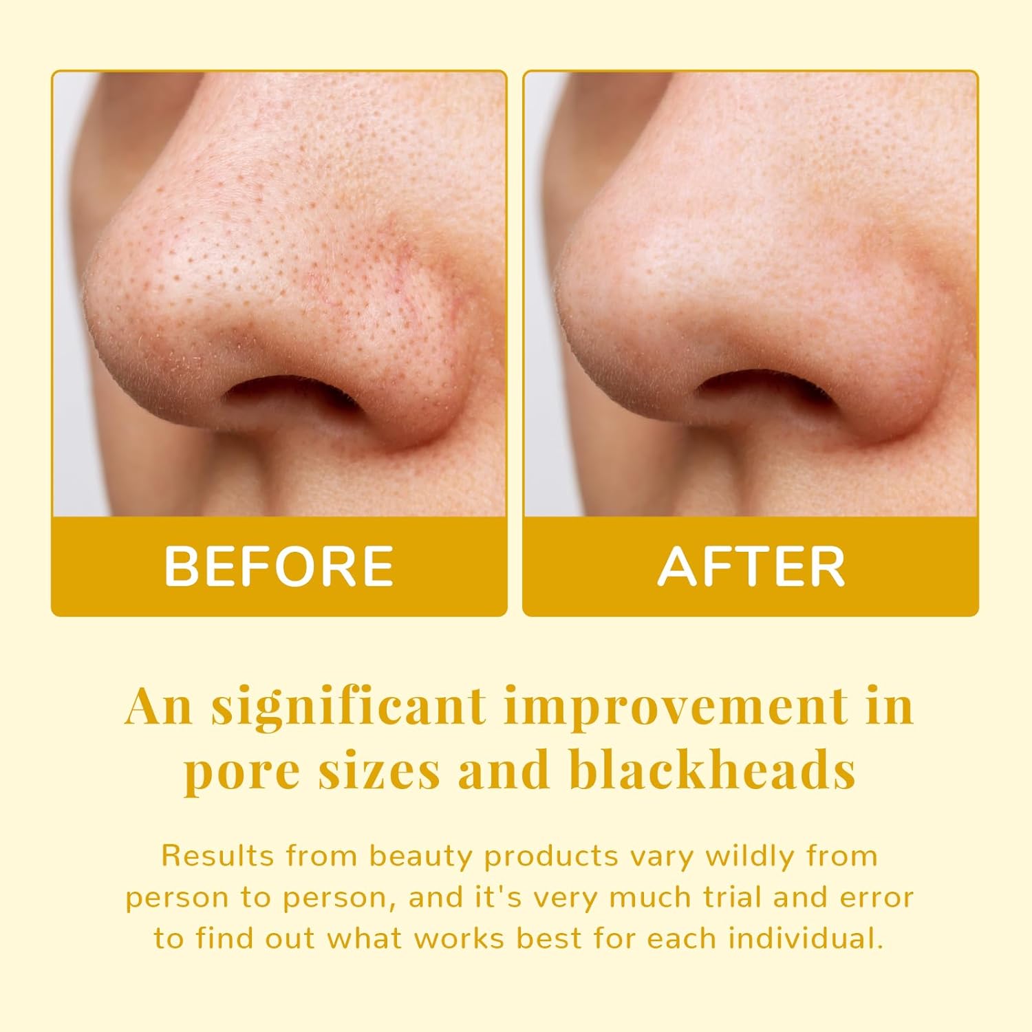 Anai Rui Pore Minimizing Pads, With Witch Hazel, Pha, Salicylic Acid, Niacinamide, Facial Toner Pads For Exfoliation And Minimizing Pores, Improving Skin Tone, Face Exfoliating Pads 50 Pads : Beauty & Personal Care