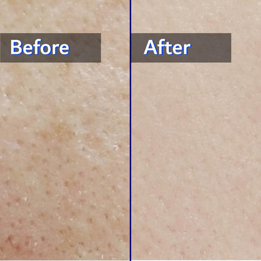 Hydrating Toner 10.14 Fl Oz - Korean Skin Care, Moisturizing Calming Toner, Vegan + Animal Testing Free, Sensetive Skin, Daily Facial & Ultra Hydrate, Natural Ingredients