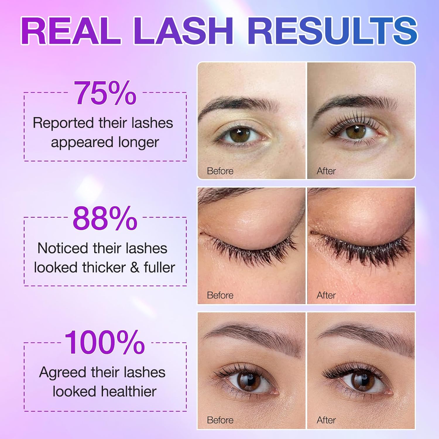 Eyelash Growth Serum, Advanced Lash Serum For Eyelash Growth, Women Eyelash Serum - Promotes Longer, Fuller And Thicker Lashes In A Month (5Ml)