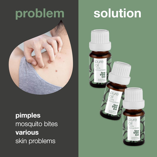 Australian Bodycare 100% Pure Tea Tree Oil, 30 Ml | Our Tea Tree Oil Is Pure And Of Pharmaceutical Grade