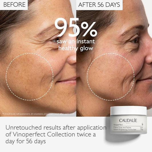 Caudalie Vinoperfect Dark Spot Moisturizer With Niacinamide - 1.7 Fl. Oz