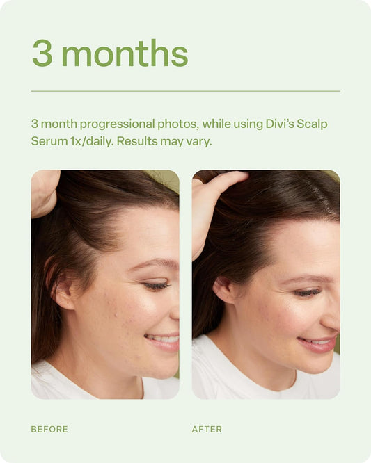 divi Hair Scalp Serum for Women and Men - Revitalize and Balance Your Scalp - Improves Appearance of Thinning Hair, Nourishes the Scalp and Helps Remove Product and Oil Buildup