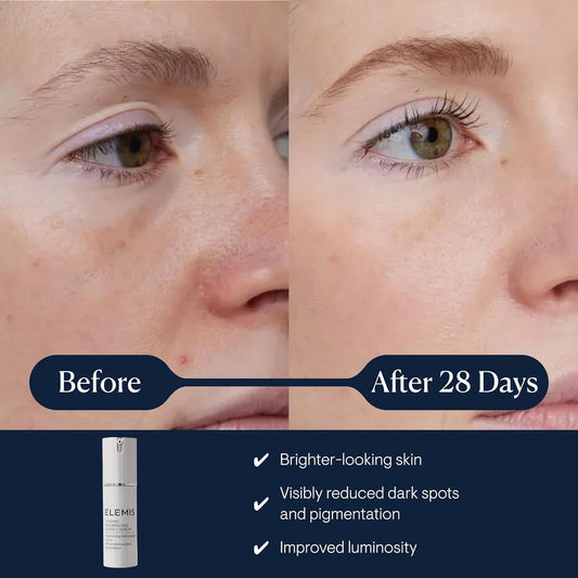 Elemis Dynamic Resurfacing Super-C Serum, Brightening Antioxidant Vitamin C Serum Refines & Illuminates, Combines Radiance Actives & Tri-Enzyme Technology To Leave Skin Looking Visibly Smoother, 30Ml