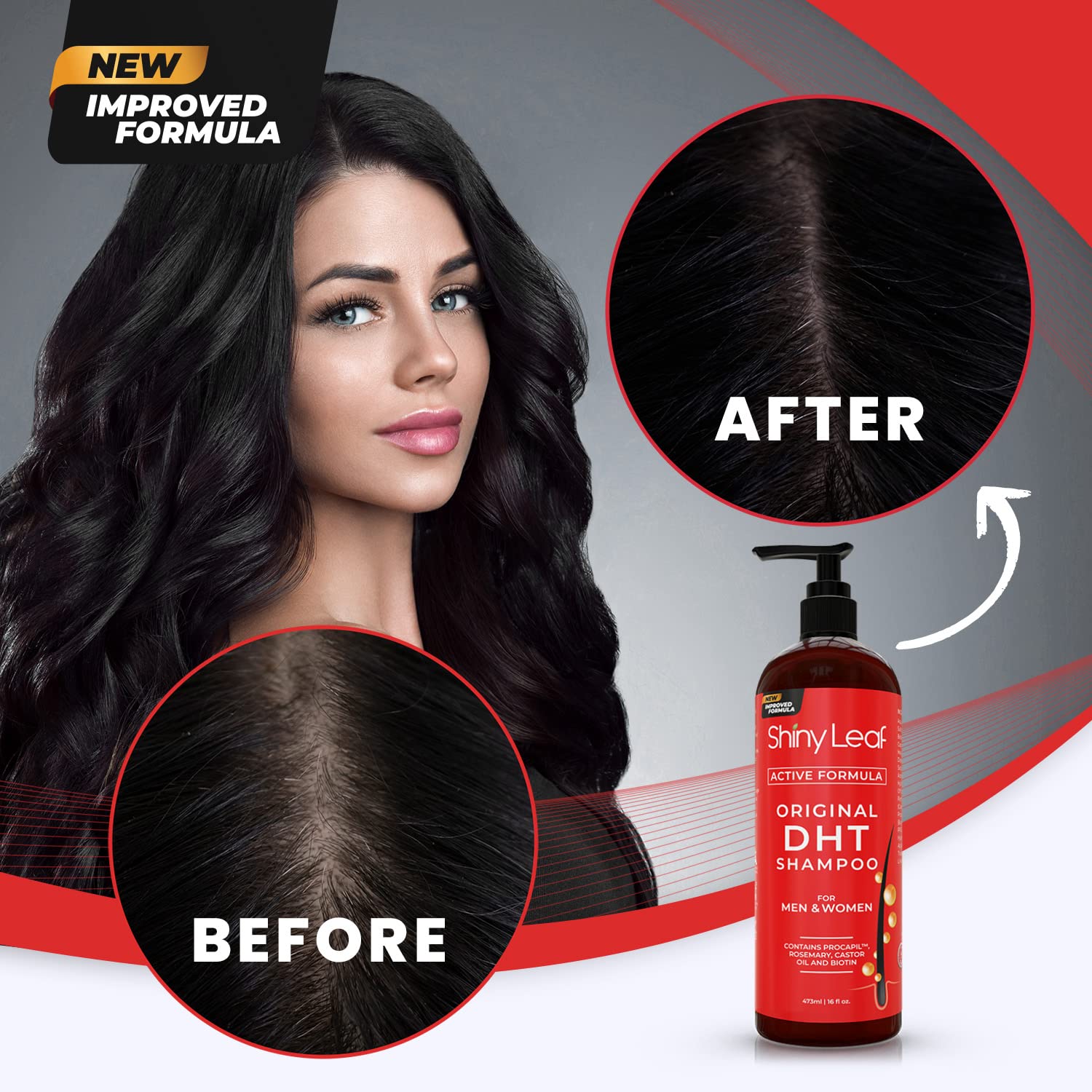 Anti-Hair Loss Shampoo With Biotin, For Men & Women - Sulfate-Free, Natural Dht Blocking Formula For Hair Growth, Thinning Hair Prevention, 16 Oz : Beauty & Personal Care