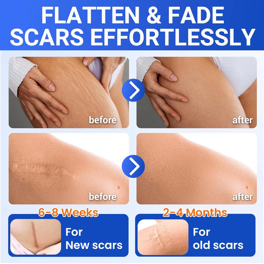Silicone Scar Sheets Surgical Tape (1.6”X120” Roll) Face Patches Acne Treatment C Section Strips, Skin-Sensitive Medical Grade Healing Scar Bandages Pads For Keloid, Stretch And Tummy Tuck Recovery