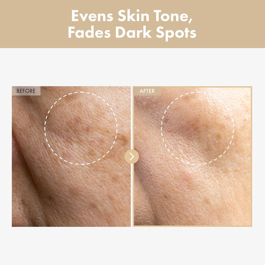 Rice Glow Milky Toner With 784,000Ppm Korean Rice Water, Niacinamide, Ceramides, Panthenol, Glow, Glass Skin, Hydrating, Purifying, Fragrance-Free, Korean Skin Care, 250Ml, 8.45 Fl.Oz