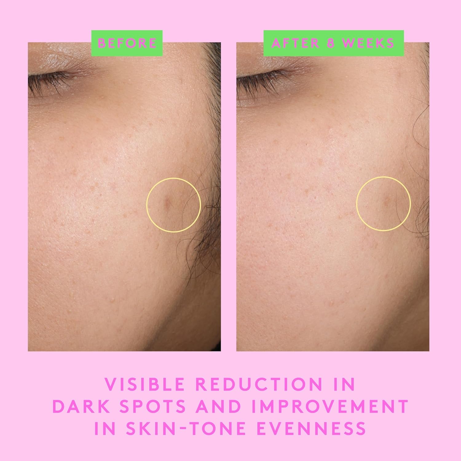Drunk Elephant B-Goldi Bright Drops - 30 Ml/1 Fl Oz - Illuminating Color Serum Drops - Clean Clinical Skincare - Cruelty-Free - Dermatologist-Tested - Free Of Essential Oils, Silicones, And Fragrance : Beauty & Personal Care