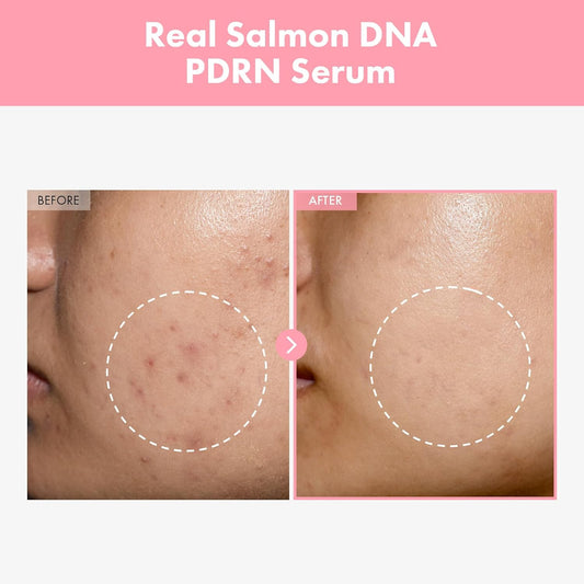 Pink Peptide 12 Pdrn Serum With Salmon Dna Pdrn 10,320Ppm, 12 Peptides, Niacinamide, Skin Glow, Hydrating, Moisturizing, Firming, Uneven Skin Tone, Korean Skincare, 33Ml, 1.11 Fl.Oz