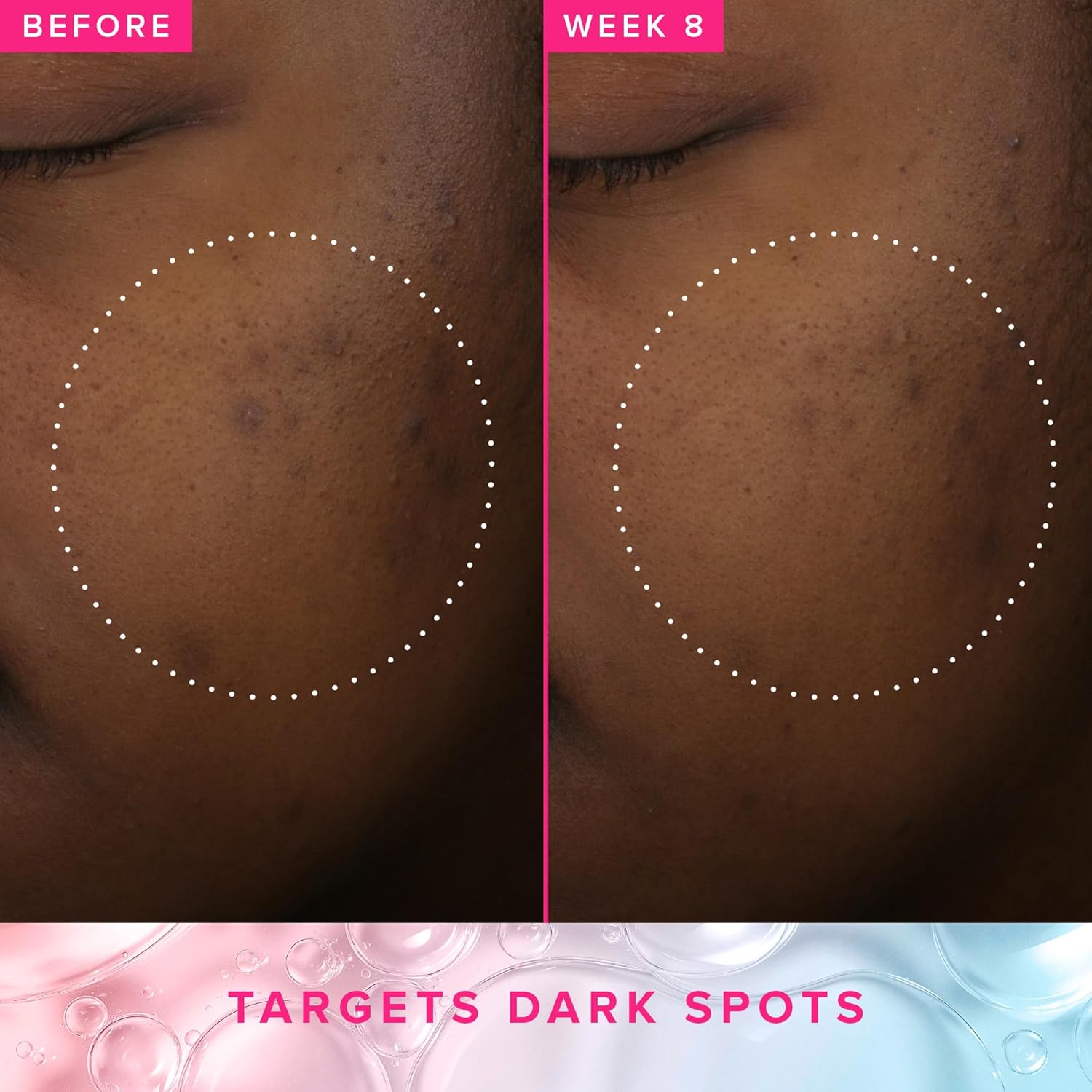 Farmacy 3% Txa Toner For Face - Brightening Face Toner For Oily Skin - Liquid Exfoliant With Azelaic Acid + 5% Pha To Target Visible Dullness + Help Reduce Uneven Skin Tone (50Ml) : Beauty & Personal Care