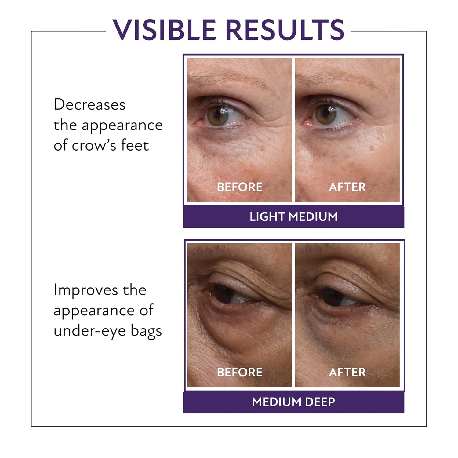 Westmore Beauty 60 Second Eye Effects - Eye Serum - Under Eye Cream - Instant Eye Tightening Serum & Instant Eye Bag Remover Puffiness - Light To Medium - Firming Serum 0.68 Fl Oz / 20 Ml