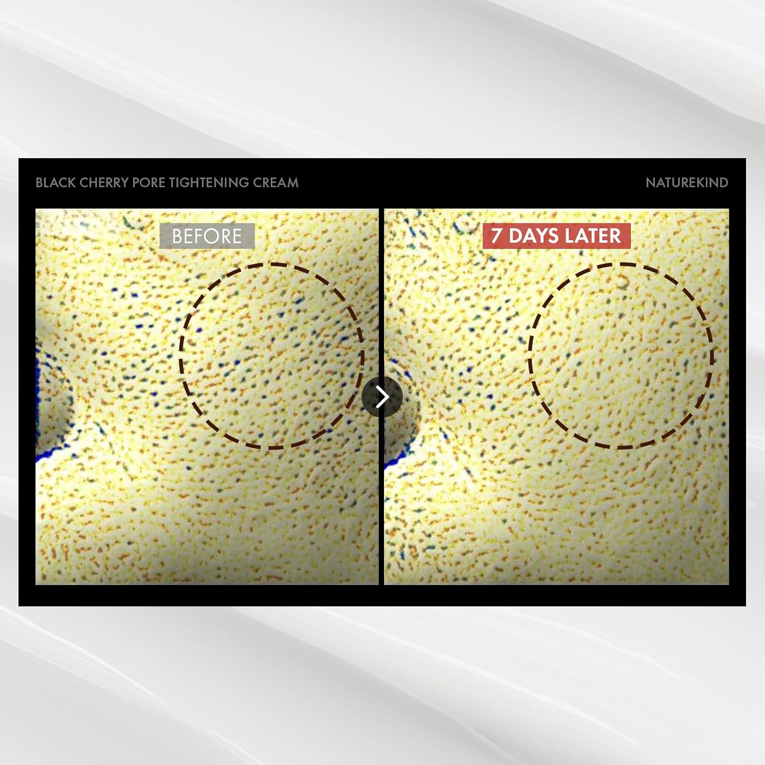 Naturekind Black Cherry Pore Tightening Cream, Minimize Enlarged Pores With A Soft Texture, Face Cream, Korean Skin Care Product 100Ml, 3.38 Fl. Oz. : Beauty & Personal Care