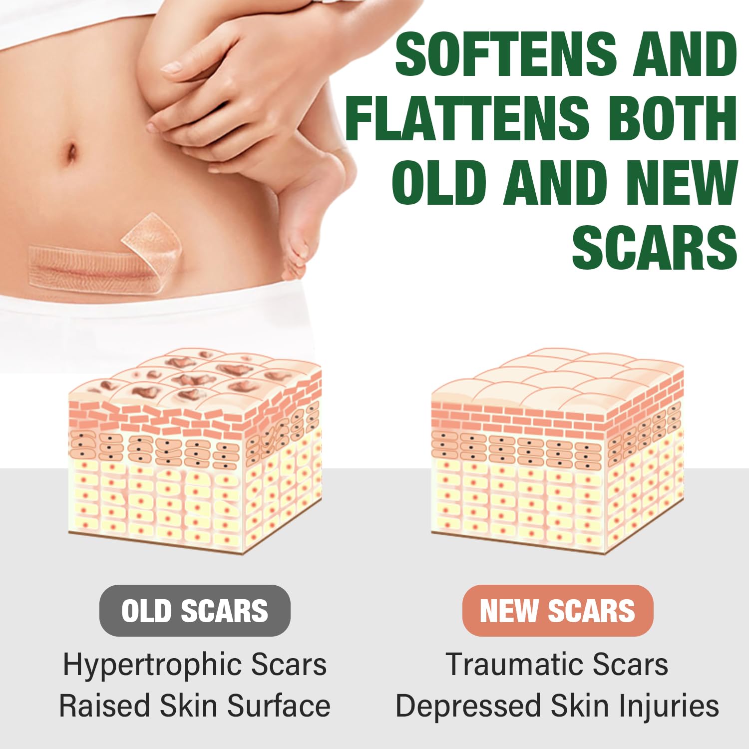 Silicone Scar Sheets,Silicone Scar Tape,Silicone Sheets For Scars,Scar Tape For Surgical Scars,Keloid Bump Removal,Scar Removal For Surgical(1.6"X 120" Roll-3M) : Health & Household