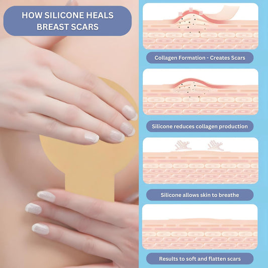 Breast Augmentation Recovery Supplies - Silicone Sheets For Healing - Comfortable Under Post-Op Bra (4 Pcs)