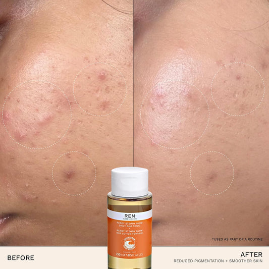 Ren Clean Skincare Glow Tonic - Cruelty Free & Vegan Pore Reducing Toner With Resurfacing Ahas & Bhas - For Daily Facial Brightening, Exfoliate, Hydrate & Even Skin Tone