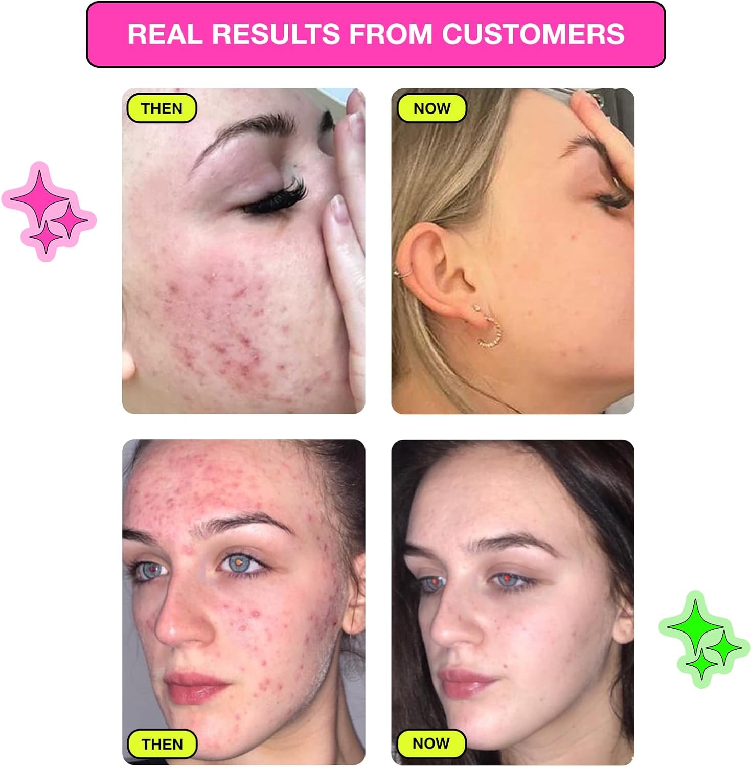 Carbon Theory | Tea Tree Oil & Citric Facial Tonic | With Pink Grapefruit | 250Ml : Beauty & Personal Care