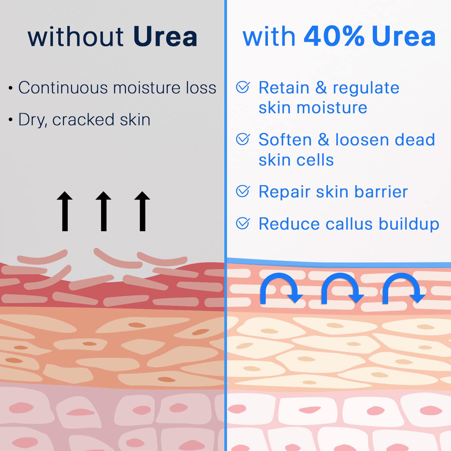 Ebanel Urea Cream 40% plus Salicylic Acid 2%, Foot Cream for Dry Cracked Heels Feet Knees Elbows Hands, Foot Dead Skin Cuticle Callus Remover Toenail Softener, Keratolytic Skin Barrier Repair Cream : Beauty & Personal Care