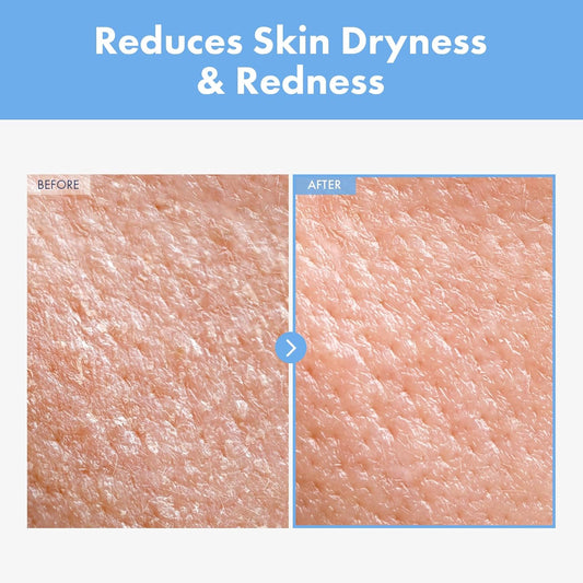 Cica Panthenol Cream, 50,000Ppm Panthenol, Centella Asiatica & Hyaluronic Acid, Barrier Repair Moisturizer For Dry, Sensitive Skin, Korean Skincare, 150G, 5.29 Oz