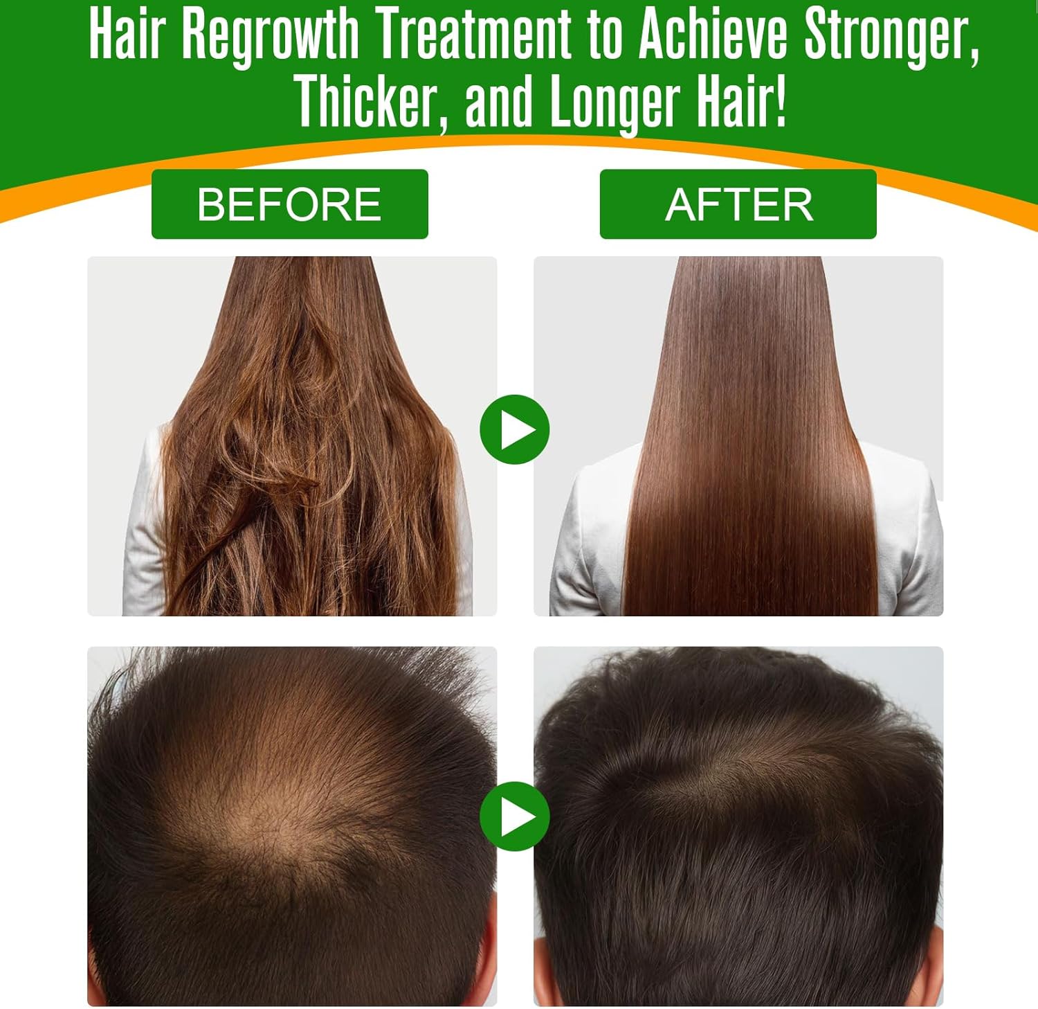 Batana Natural Oil For Hair Growth - Repairs Damaged Hair, Thicker Fuller Hair, Face & Body Massage Oil