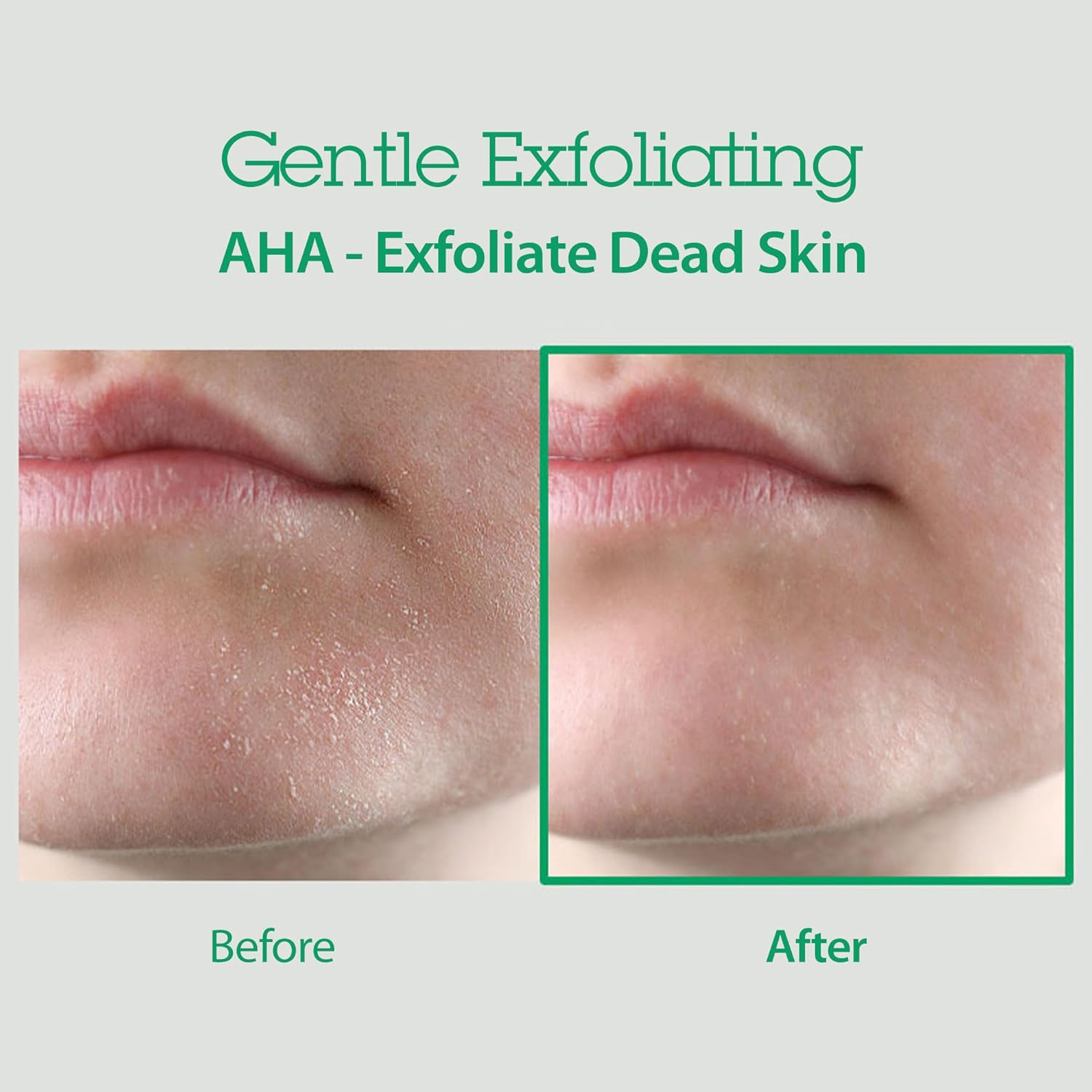 Blithe Aha Bha Cleanser - Deep Pore Cleanser And Pore Minimizer, Exfoliant For Face, For Clogged Pores, 5.07 Fl Oz : Beauty & Personal Care