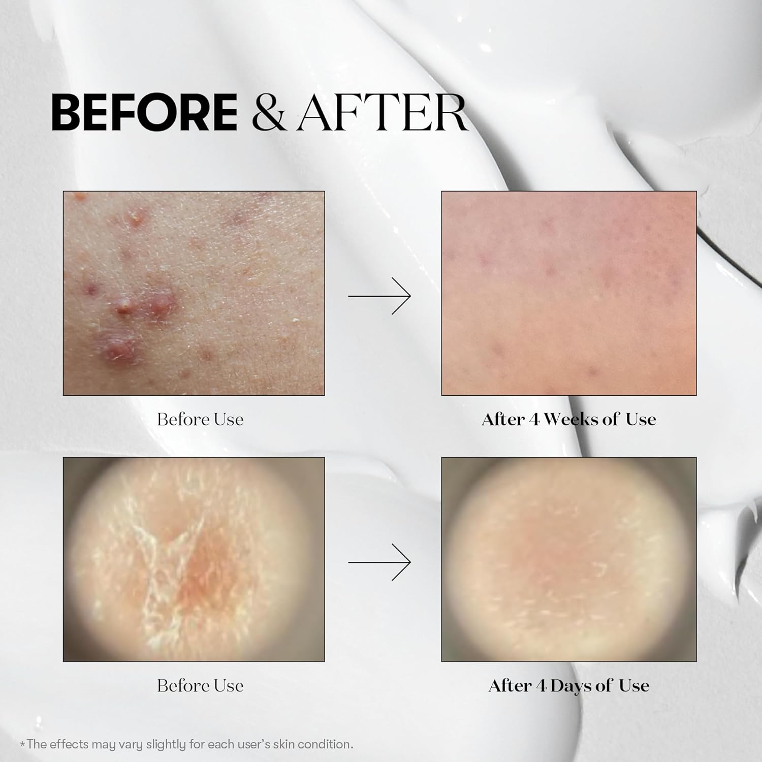 Vt Cosmetics Cica Reedle Shot 300, Advanced Night Exosome, Microneedling Serum, Centella Asiatica, Hyaluronic Acid, Propolis, Soft Skin, Regeneration, Glass Skin, Korean Skin Booster 1.69Fl Oz (50Ml) : Beauty & Personal Care