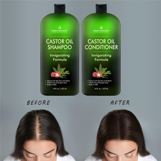 Castor Oil Shampoo And Conditioner - A Anti Hair Loss Set Thickening Formula For Hair Regrowth, Anti Thinning Sulfate Free Product With Tea Tree Oil & Biotin For Men And Women - 16 Oz