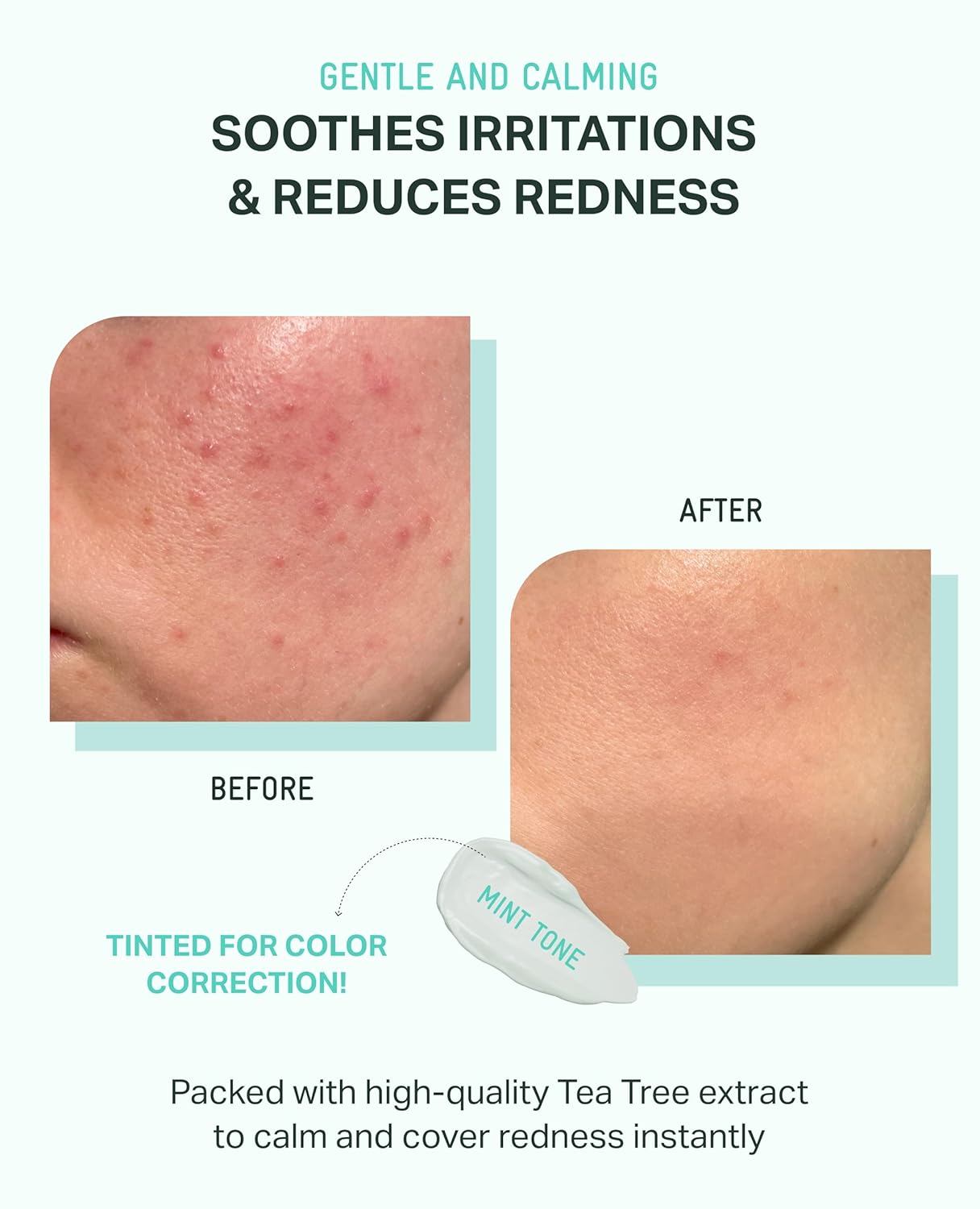 Bring Green Tea Tree Cica Mineral Sunscreen Spf 50+ Pa++++ | Non-Nano Zinc Oxide Face Sun Lotion, Reef Safe Korean Sunscreen For Sensitive Skin, Oil-Free, 1.69 Fl. Oz : Beauty & Personal Care