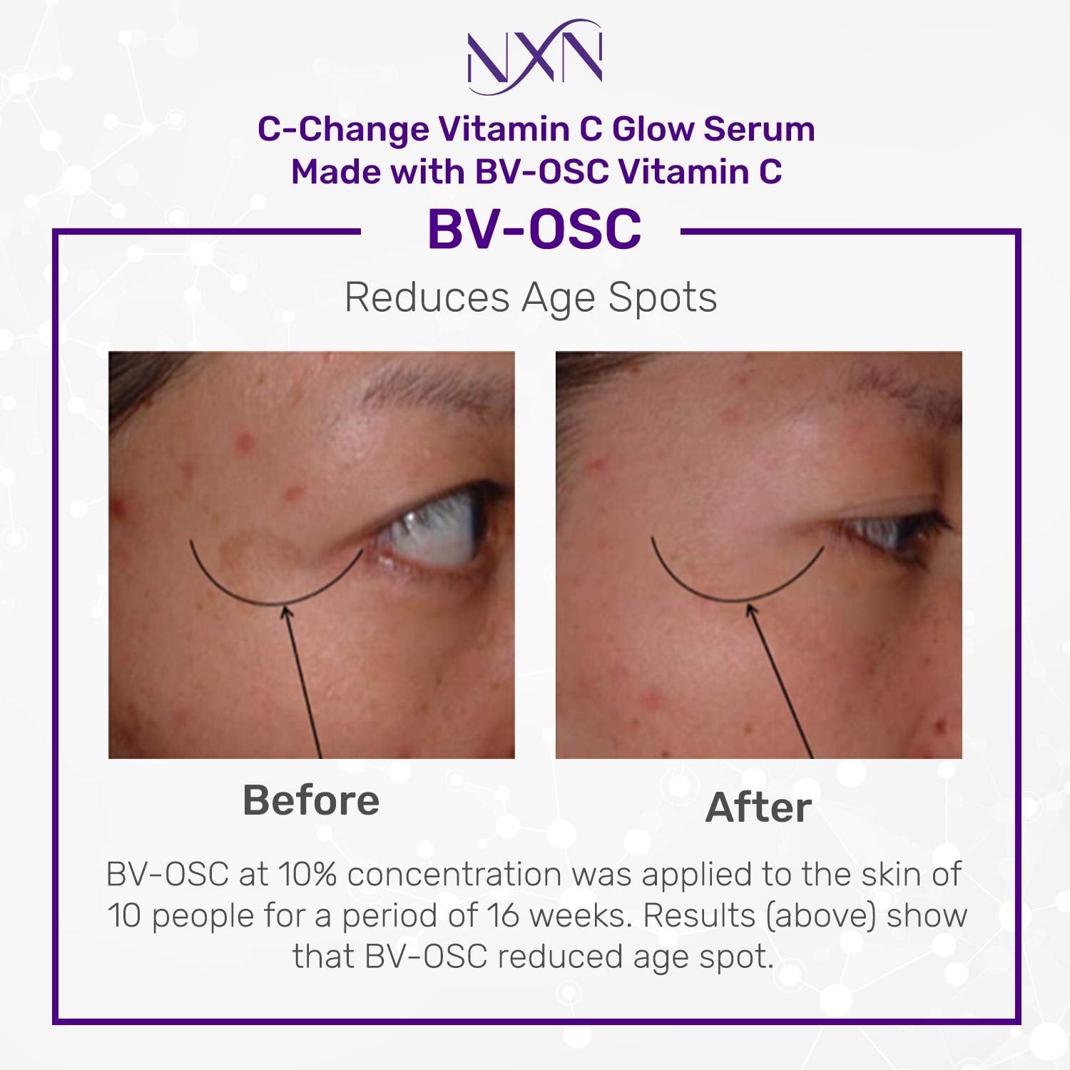 Nxn Hyaluronic Acid Face Serum - Hydrate Skin, Boost Collagen, Reduce Lines & Wrinkles - All Skin Types : Beauty & Personal Care