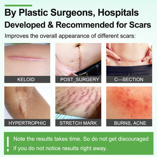 Silicone Scar Sheets(1.8” X 157”Inch- 4M), Scar Tape, Scar Strips, Medical Grade, Scar Remover, C-Section, Surgery, Keloid, Tummy Tuck, Scar Patch