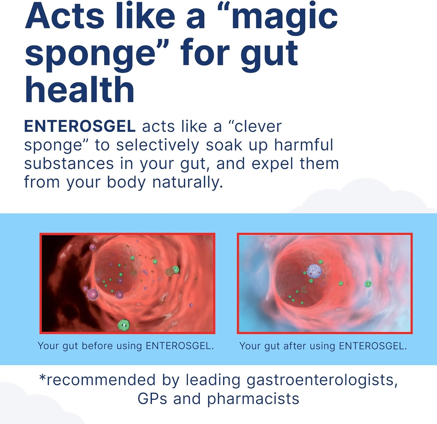 ENTEROSGEL Diarrhoea Relief for Children - Gastroenteritis Treatment, Tummy Bug Relief, Kids Stomach Bug Treatment, Traveler’s Diarrhea First Aid Kit, Stomach Pain Relief - for Babies & Children, 90g : Amazon.co.uk: Health & Personal Care