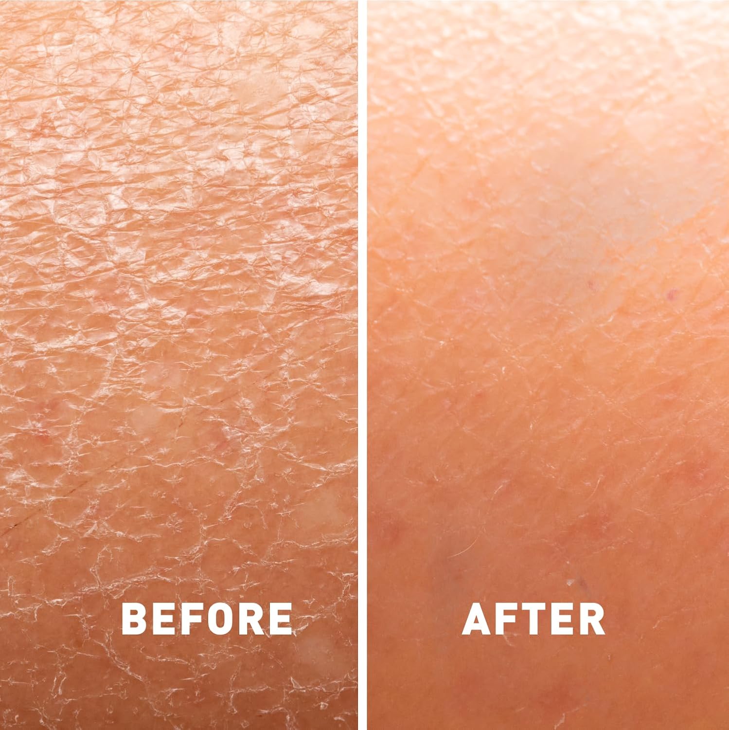 Just Nutritive Skin Calming & Healing Lotion | Organic Moisturizer for Treatment of Dry, Cracked or Irritated and Itchy Skin | Eczema Lotion Provides Long-lasting Relief 16 Oz : Health & Household