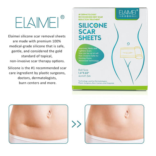 Medical Grade Silicone Scar Sheets, Silicone Scar Tape (1.6”X 60”), Scar Removal Strips For Acne Scars C-Section & Keloid Surgery Scars Sheets Treatment Sheets - 6-8 Month Supply