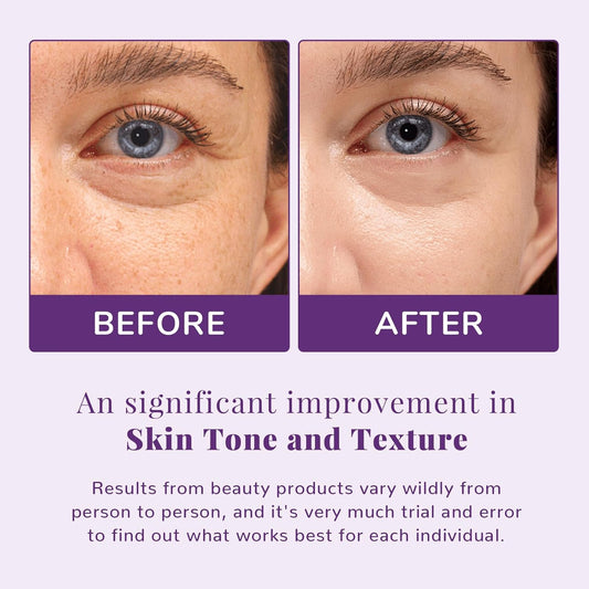 Anai Rui Niacinamide Facial Radiance Pads, With Glutathione, Niacinamide, Lha, Pha - 50 Pads For Even Skin Tone, Reduce Blemish And Spots