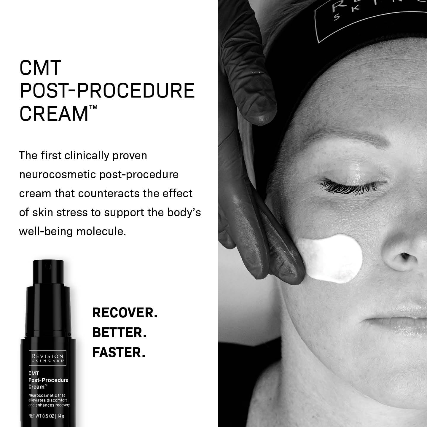 Revision Skincare Cmt Post-Procedure Cream™, Clinically Tested Post-Procedure Skin Care, Sensitive Skin Moisturizer For Microneedling, Irritated Skin, Supports Recovery & Restores Skin Barrier, 0.5 Oz