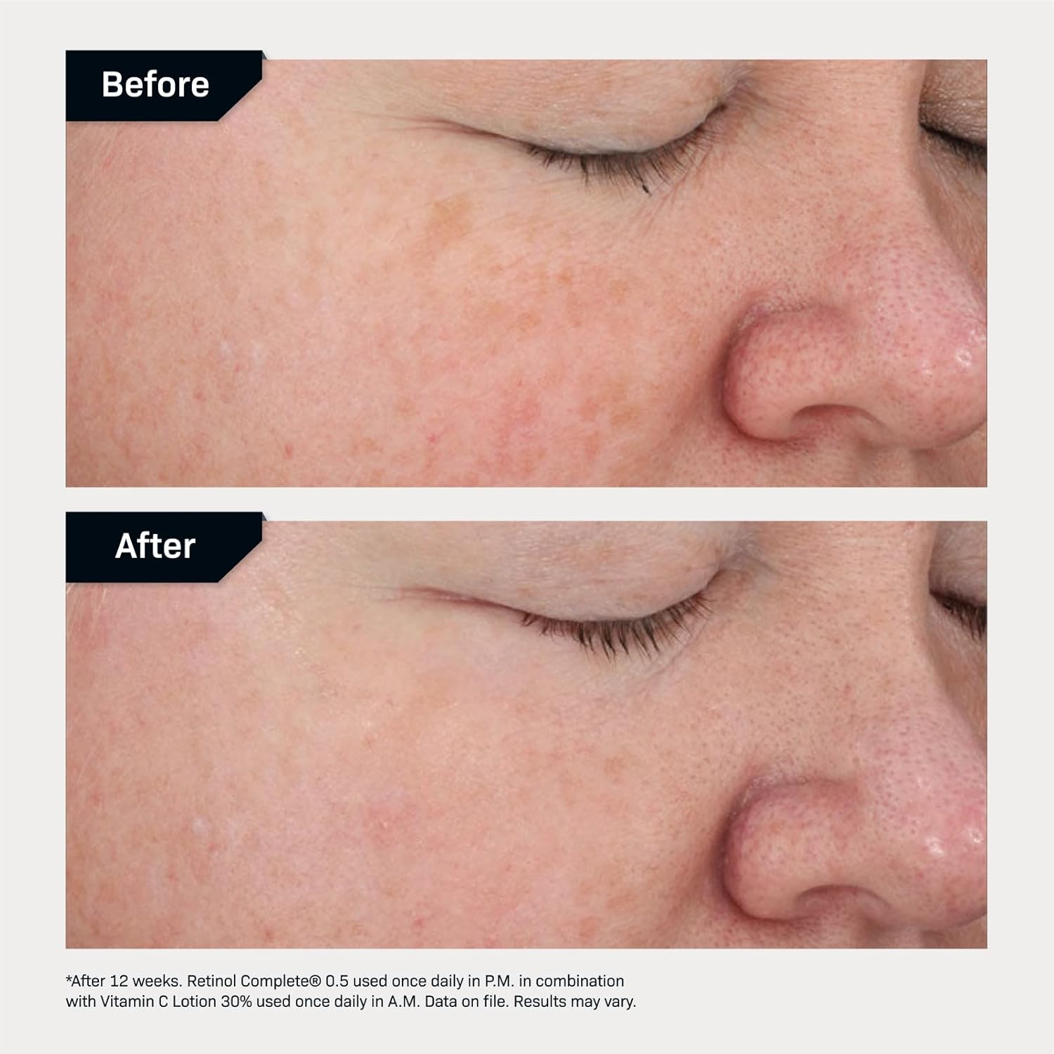 Revision Skincare Vitamin C Lotion 30% (Packaging may vary), 1 Fl Oz (Pack of 1)