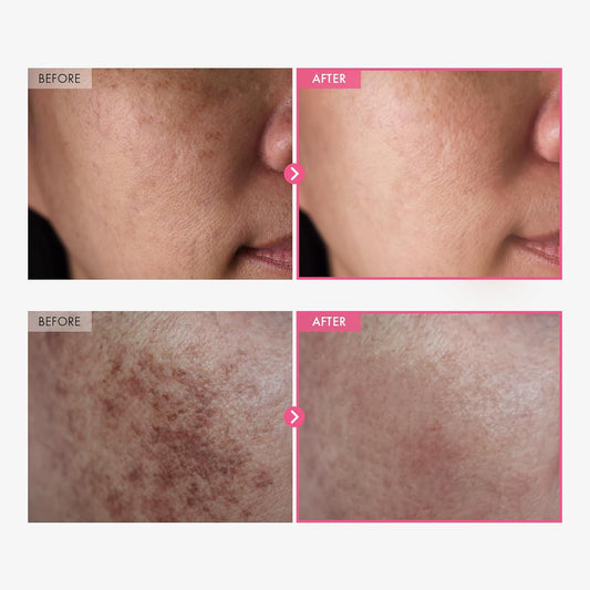 Tosowoong Arbutin 7% + Tranexamic Acid 4% Cream, 70,000Ppm Arbutin, 40,000Ppm Txa, Niacinamide, Glutathione, Dark Spots, Freckle, Blemishes, Pigmentation, Korean Skin Care, 50Ml, 1.69 Fl.Oz