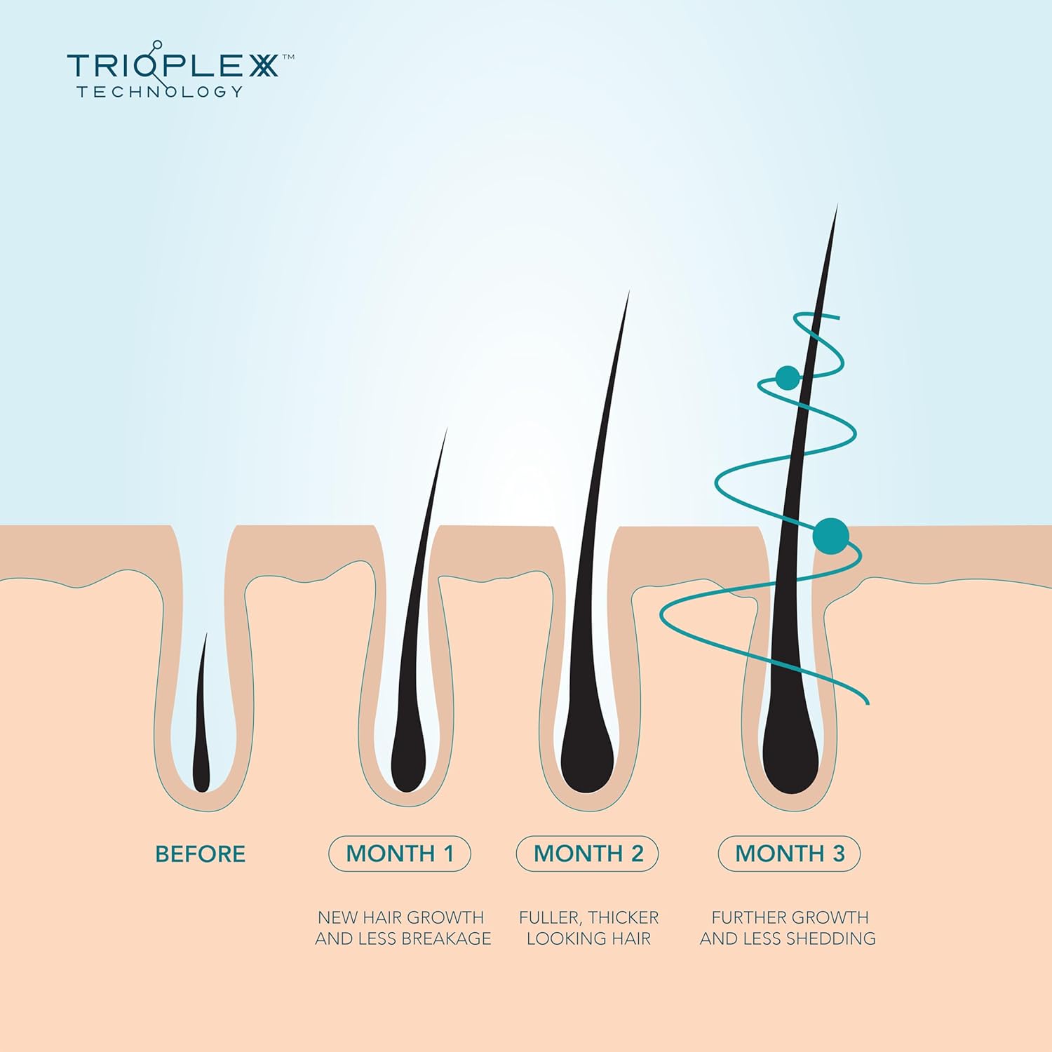 We Are Paradoxx Growth Advanced Scalp Serum - Special Trioplexx Technology Stimulates Scalp And Hair Follicles - Hair Looks Thicker And Healthier - Caffeine, Keratin, Biotin - Natural, Vegan - 50Ml : Beauty & Personal Care