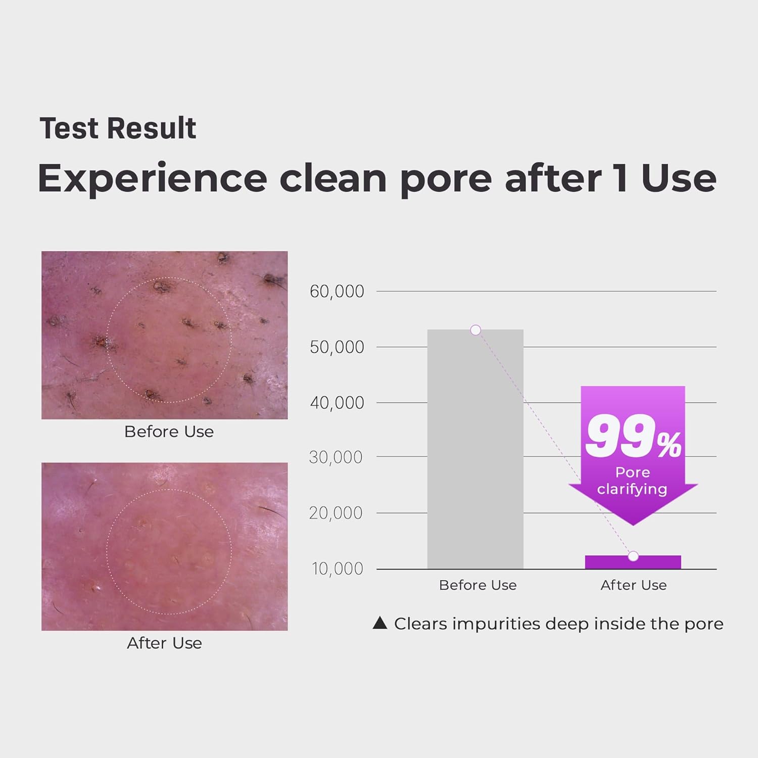 Grafen Cleansing Balm Makeup Remover Dermabiome - Korean Makeup Remover Balm Melt Down At Body Heat, Deep Pore Cleansing & Sebum Control, Hydrated Cleansing, One-Touch Cap & Spatula Included : Beauty & Personal Care
