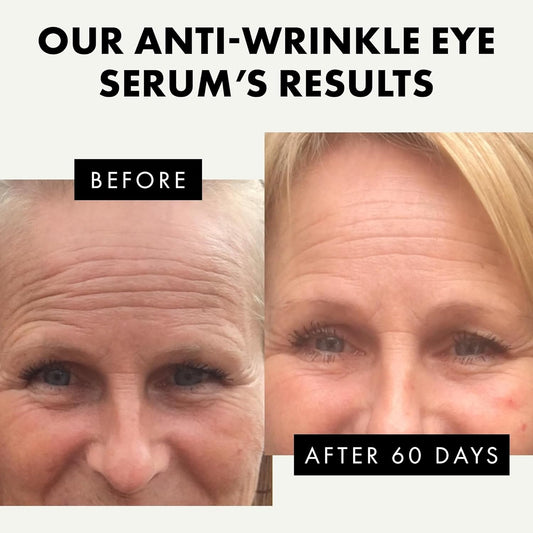 * Eye Serum - Under Eye Cream For Dark Circles And Puffiness - Anti Aging Eye Cream, Under Eye Brightener Eye Bags Eye Treatment, Caffeine Eye Cream Puffy Eyes Treatment Dark Circle